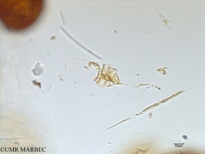 phyto/Scattered_Islands/mayotte_lagoon/SIREME May 2016/Eucampia cornuta (MAY3_guinardia-2).tif(copy)_thumb.jpg